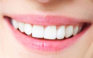 Dentista Gallarate - Protesi Estetica